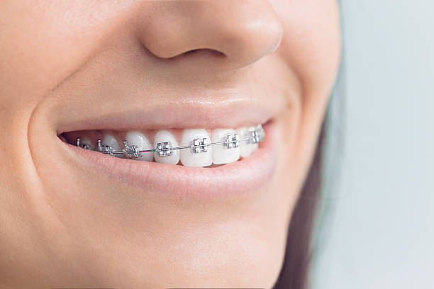 Best Dentures (Full and Partial)  in Bellevue, IL
